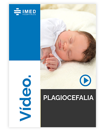 Plagiocefalia