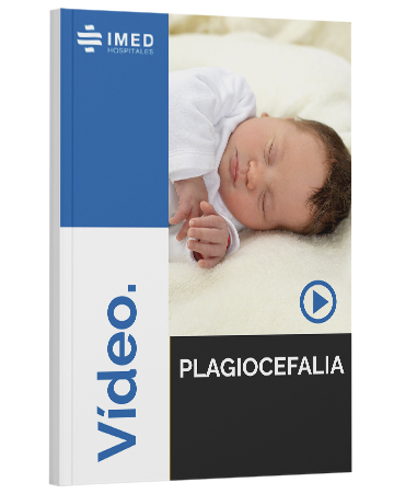 Plagiocefalia