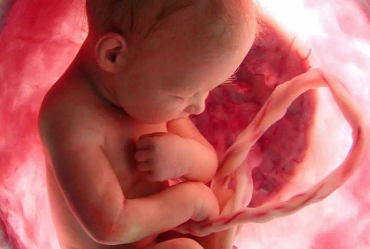 principal-imagenes-cordon-umbilical-es_grande.jpg