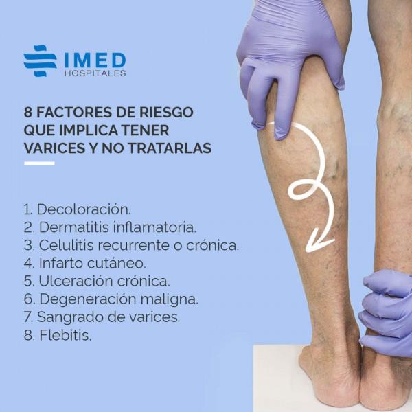 principal-imagenes-varices-es_grande.jpg
