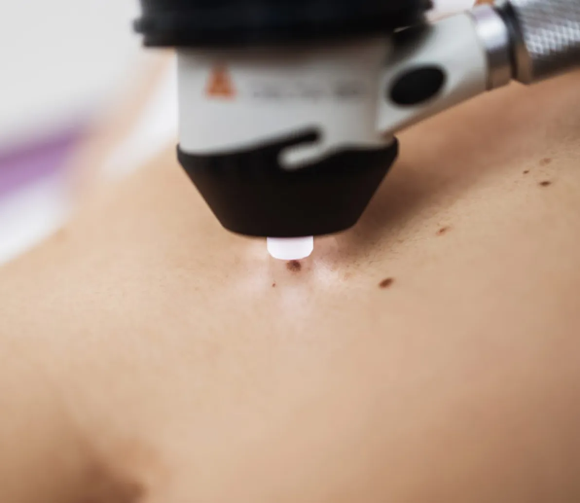 Dermatologi