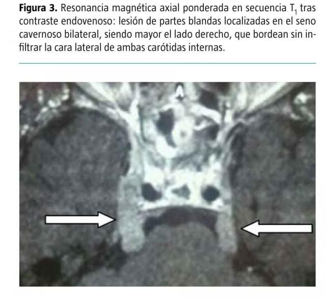 principal-imagenes-figura-3-es_grande.jpg