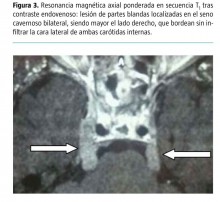 Figura 3