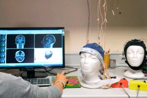 IMED Elche Colabora Con Investigadores De La UMH En El Desarrollo De Una Técnica Pionera Para Implantar Microelectrodos En El Cerebro De Personas Ciegas